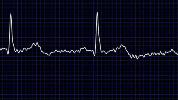 Uno smartwach che previene gli infarti? Il piano di Apple