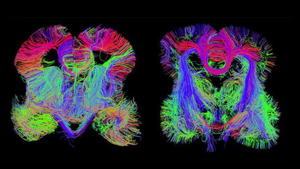 Dagli Usa arriva la prima mappatura del cervello