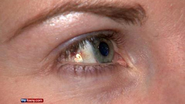 Platino tatuato negli occhi, la nuova moda globale