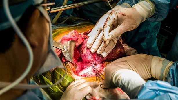 Organi umani cresceranno nei corpi degli animali
