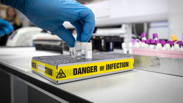 Il coronavirus? Un virus artificiale, dice un nuovo studio