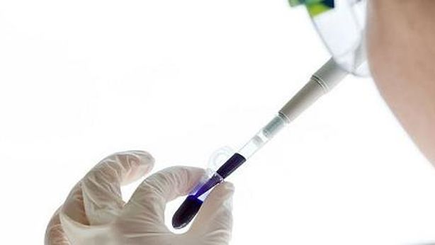 Death test, l’esame del sangue che vi dice se morirete nei prossimi 5 anni