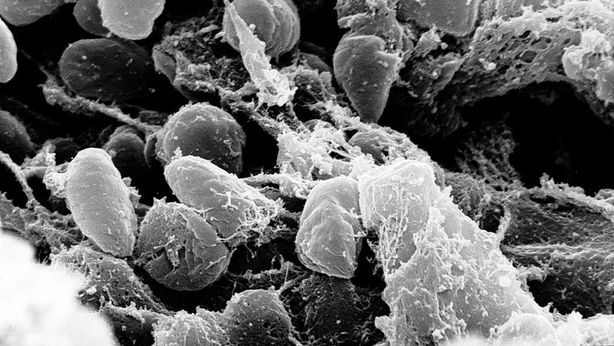 Batterio misterioso provoca 20 morti negli Stati Uniti