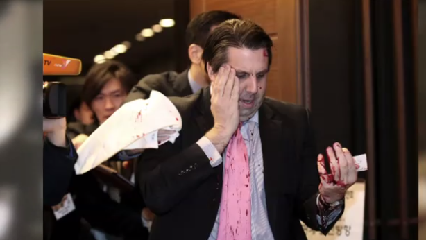 Ambasciatore Usa ferito. Nordcorea: “giusta punizione per guerrafondai americani”
