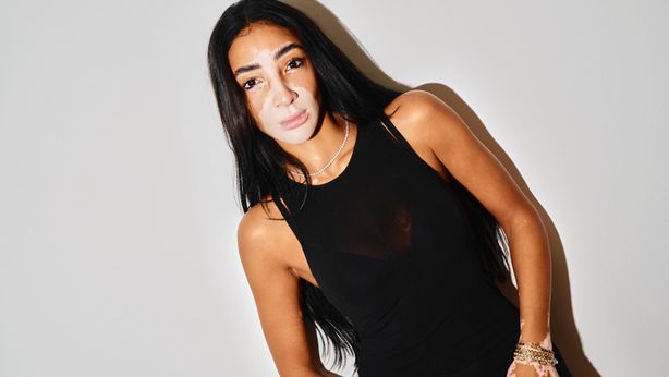 Logina Salah: “La bellezza non è perfezione ma autenticità e coraggio”
