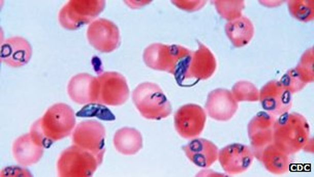 Malaria, scoperto un nuovo parassita resistente alle cure