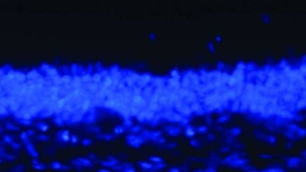 Scienza: è italiana la prima retina artificiale biocompatibile